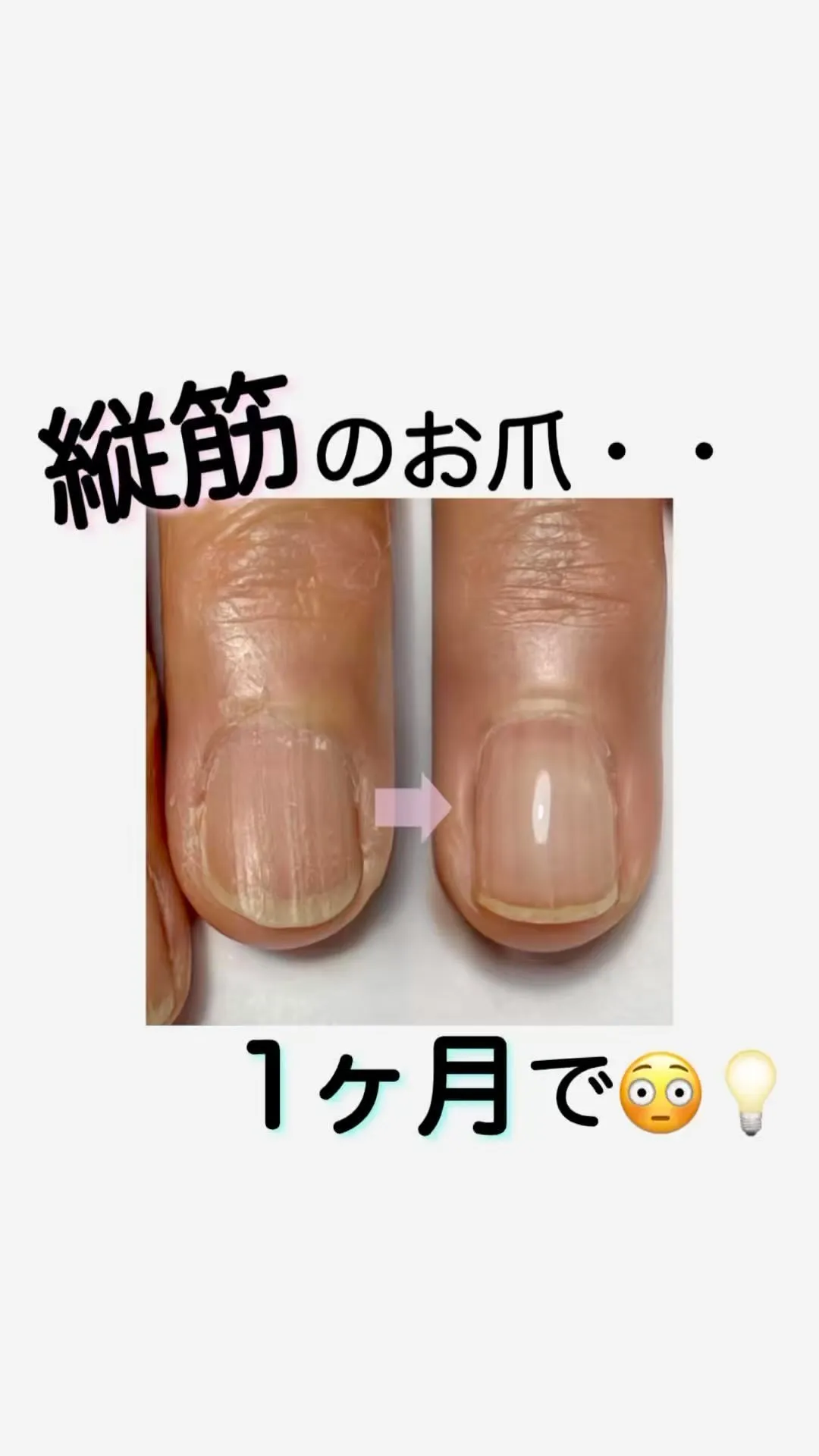 たった1ヶ月でこんなにも変わる😳⁉️